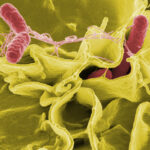 Salmonella is one of the causes of Foodborne Illness