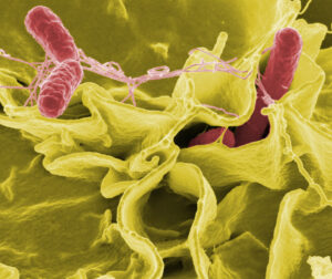 Salmonella is one of the causes of Foodborne Illness